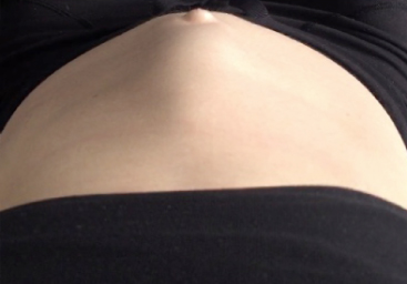 I'm Pregnant and Huge - A Diastasis Recti Story