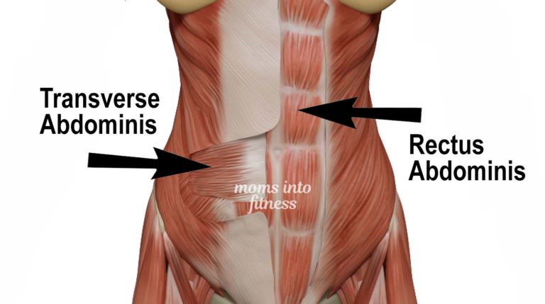 Diastasis Recti Programs - Workouts for Diastasis