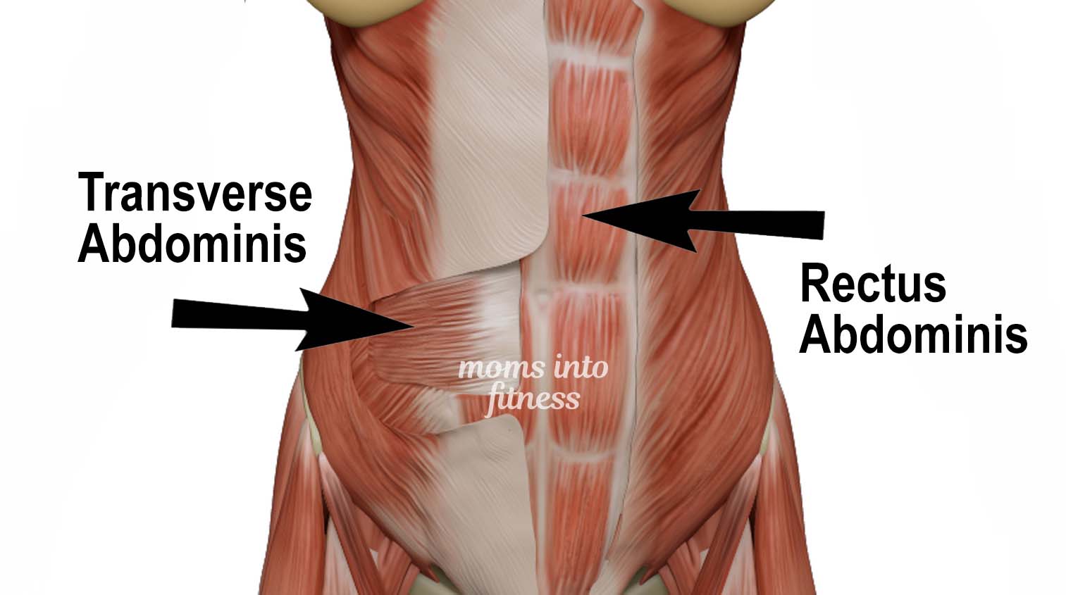 Diastasis Recti Programs - Workouts For Diastasis